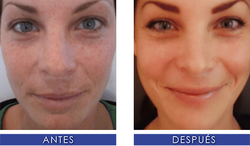 Manchas y pigmentaciones