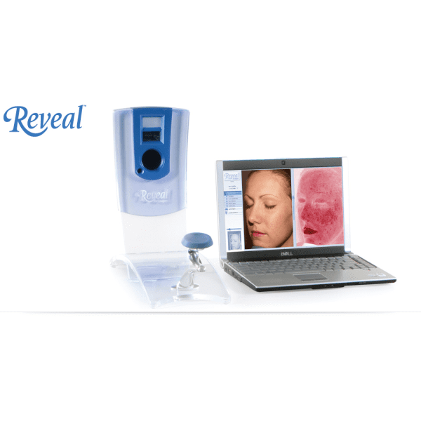 3d Facial