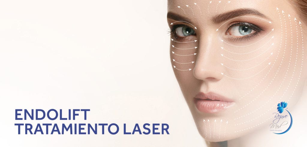 Endolift Tratamiento Laser Lima