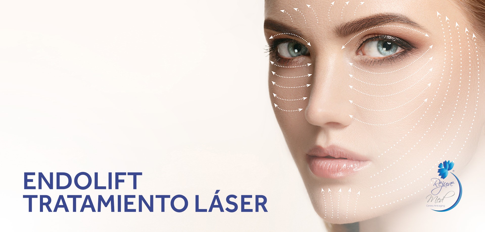Endolift, rejuvenecimiento láser en Lima
